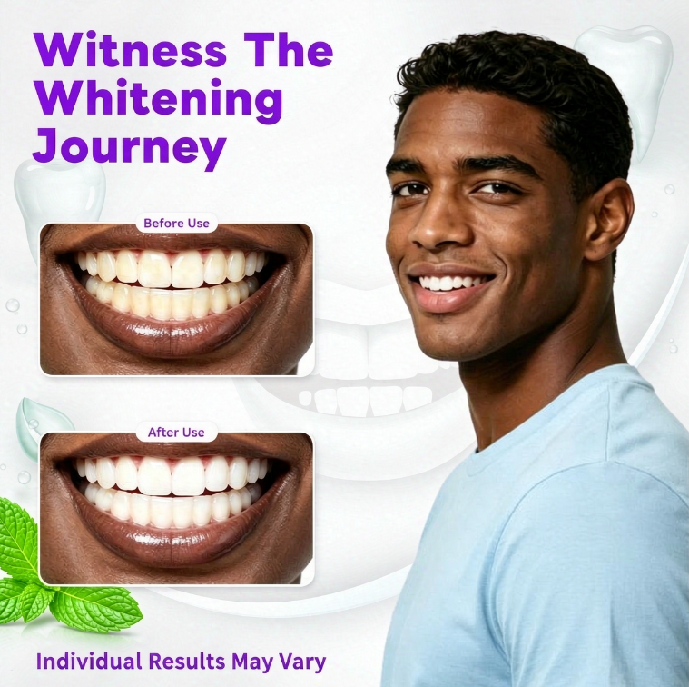 OEM Purple PE Whitening Teeth Strips Sensitivity-Free Home Use 7-28 Treatments Custom Packaging