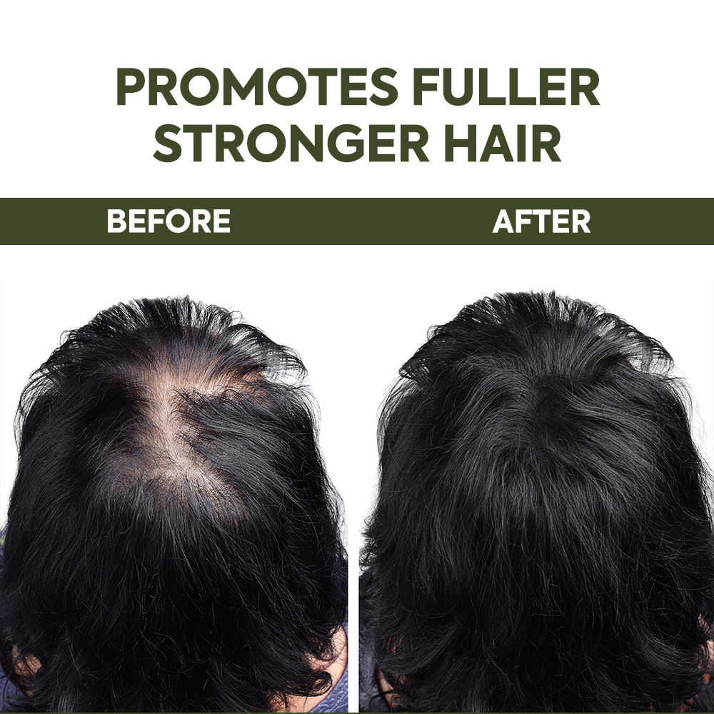 OEM Herbal Hair Growth Spray & Serum Mist-Scalp Strengthening 2in1 Hair Regrowth Oil